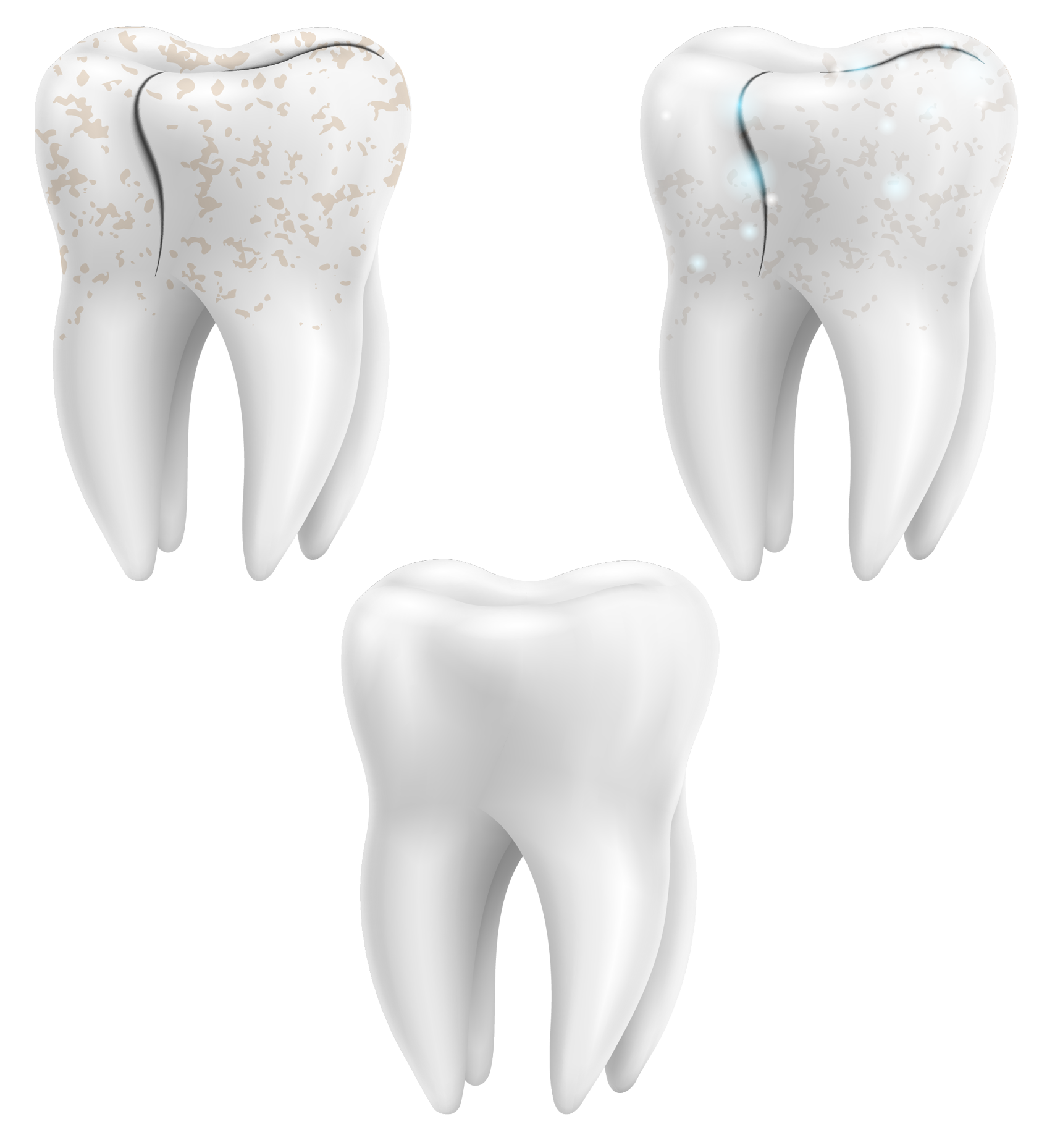 Optimum Dental Restoratif Diş Hekimliği Aydın